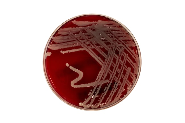 CASO-AGAR MIT 5% SCHAFBLUT (VE=10 Platte
